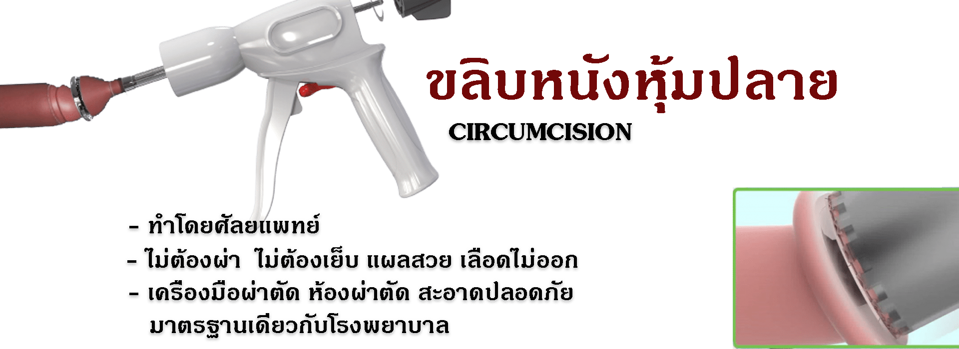 เเกนองคชาต ขลิบหนังหุ้มปลาย ประเภทของแกนองคชาตเทียม