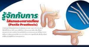 ใส่เเกนองคชาต