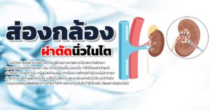 นิ่วในไต