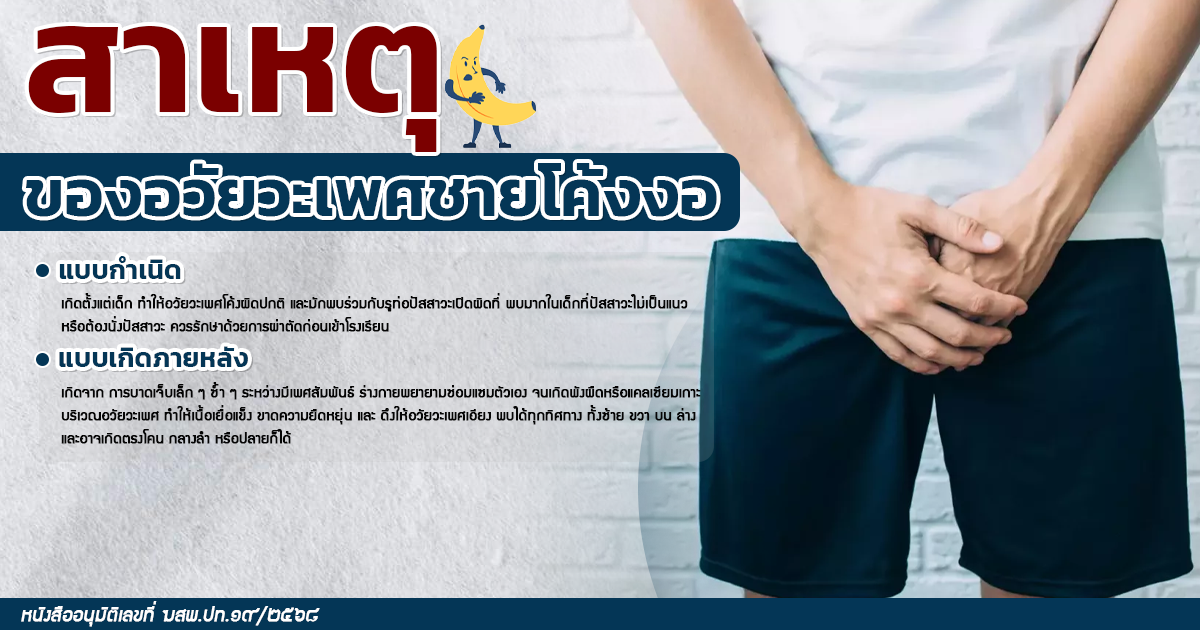 จู๋โค้ง จู๋งอ