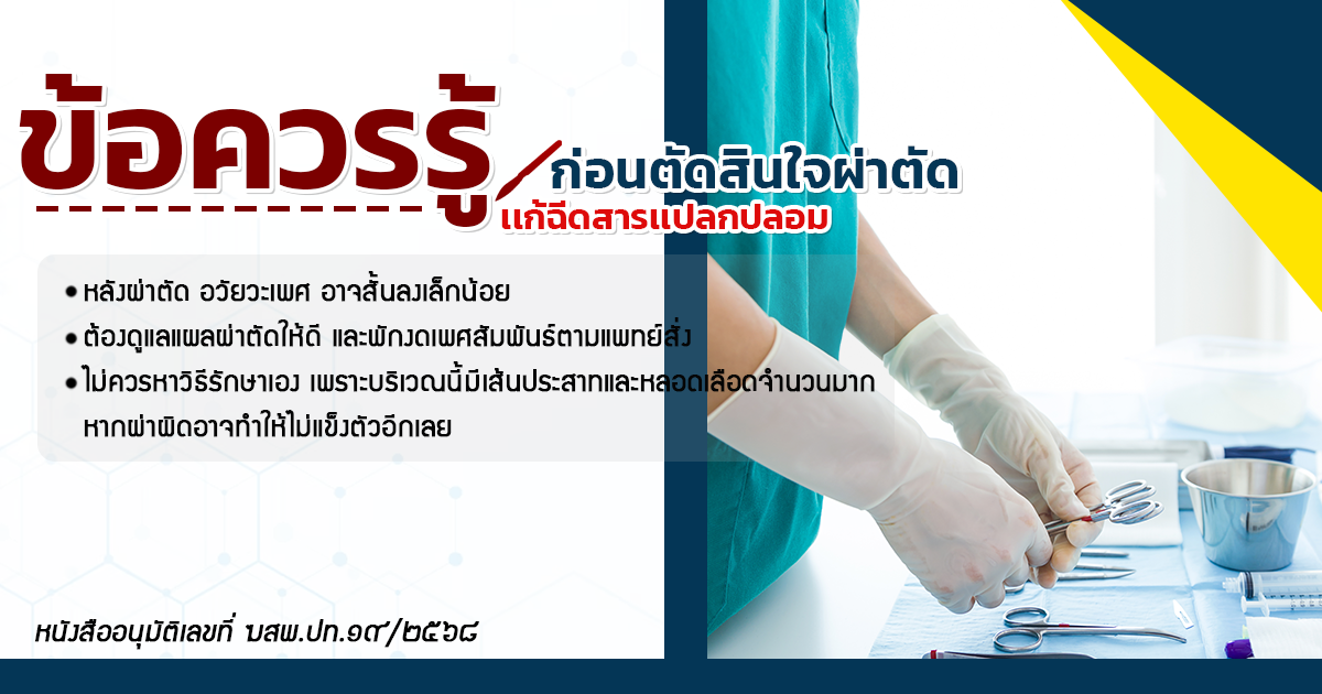 จู๋โค้ง จู๋งอ