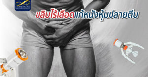 ขลิบไร้เลือด