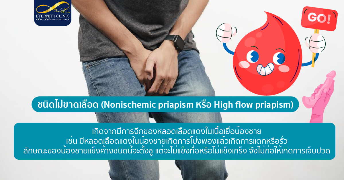 ชนิดไม่ขาดเลือด