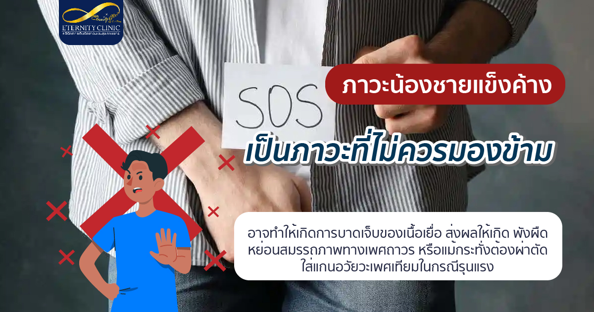 ภาวะน้องชายแข็งค้าง
