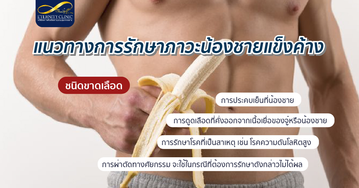 แนวทางการรักษาภาวะน้องชายแข็งค้าง