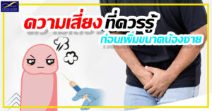 เพิ่มขนาดน้องชาย