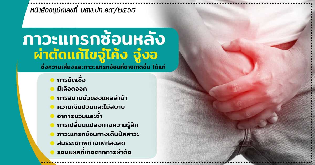 จู๋โค้ง จู๋งอ