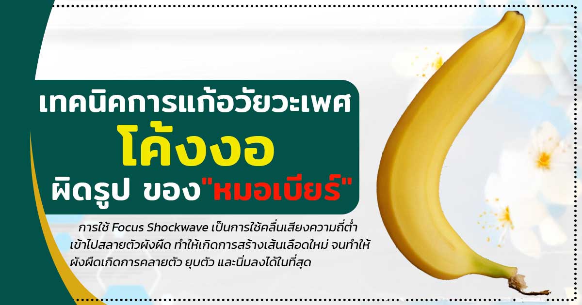 แก้น้องชายโค้งงอ