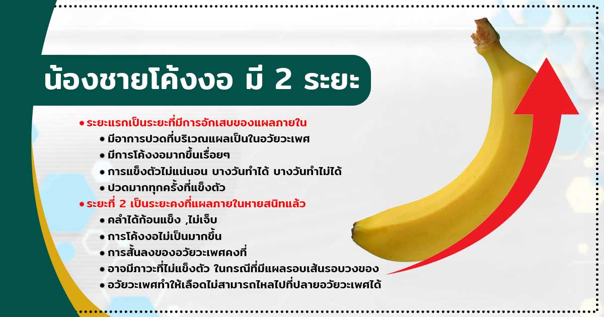 น้องชายโค้งงอ