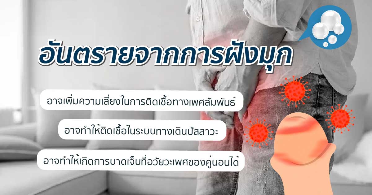 ตกเเต่งอวัยวะเพศ