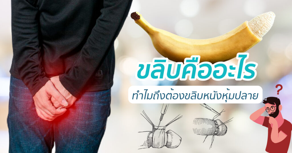 ขลิบคืออะไร ทำไมถึงต้องขลิบหนังหุ้มปลาย หมอเบียร์ ETERNITY CLINIC